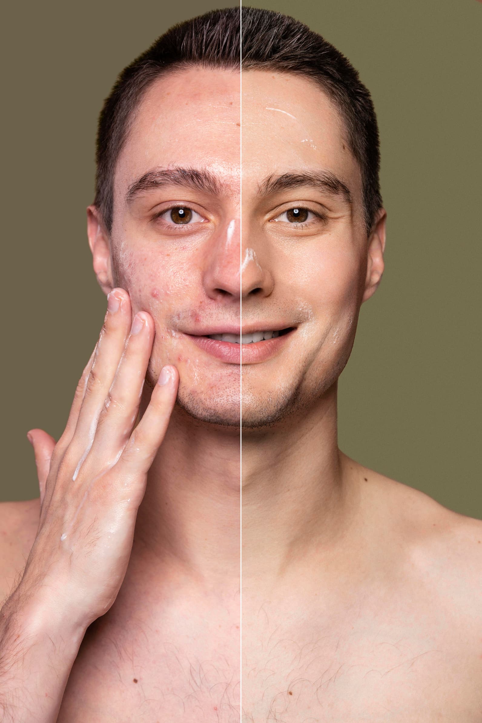Antes e depois real de procedimento estético em homem